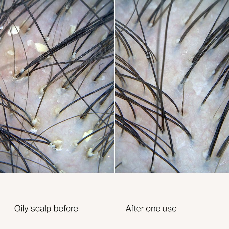 Scalp Care Exfoliator Soin Avant-Shampooing